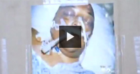 Independent Autopsy Shows Man Died From Police Brutality