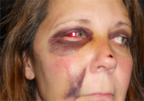 Woman Brutaly Beaten By Police [Graphic Pictures]