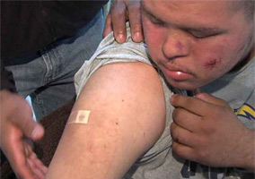 Man with Down Syndrome Maced and Beaten By Sheriff's Deputy